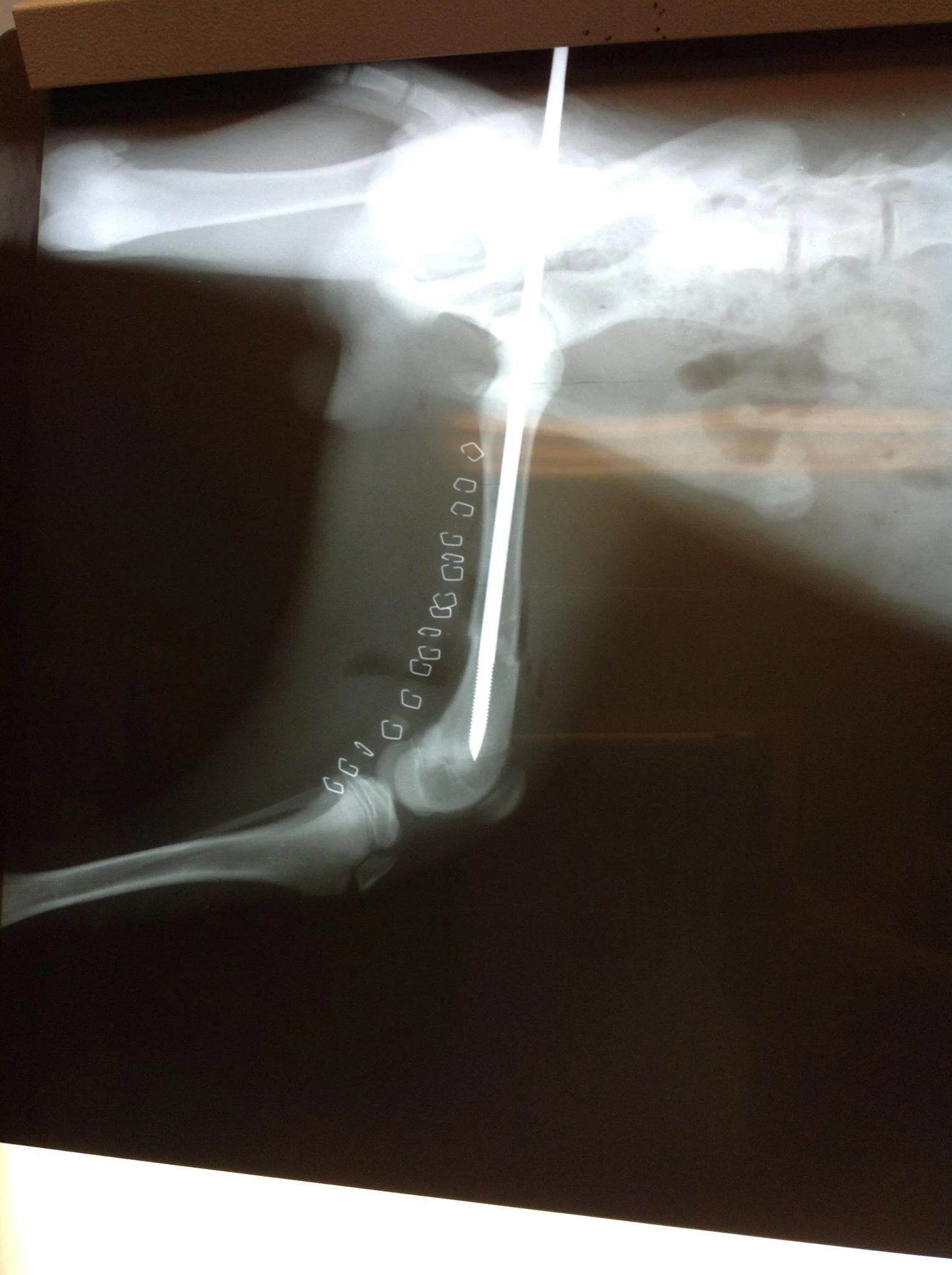 An orthopedic radiograph published by Highland showing a limb with a surgical pin.